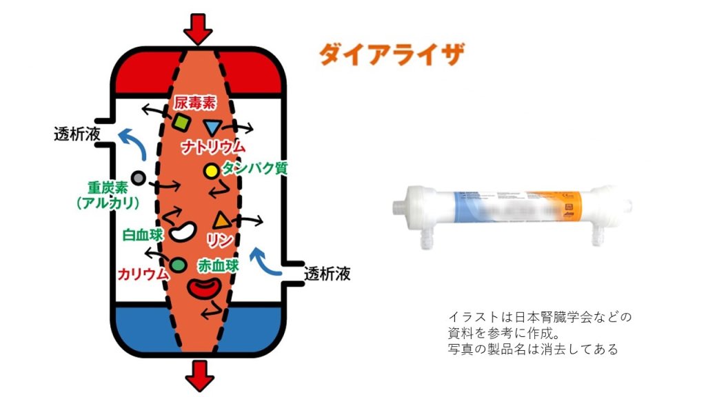 ダイアライザ　日本腎臓学会　日本式医療　ニプロ　輸出　人工透析